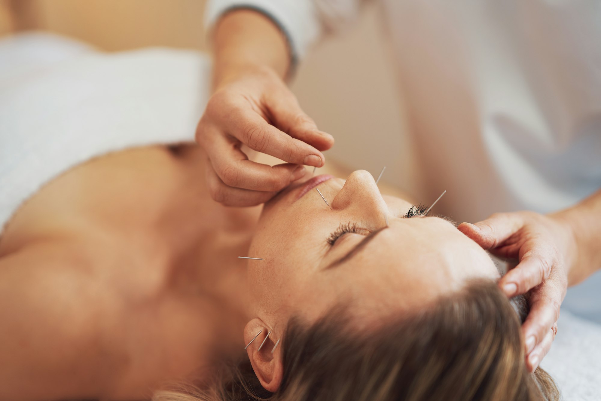 A acupuncture needle therapy in the studio